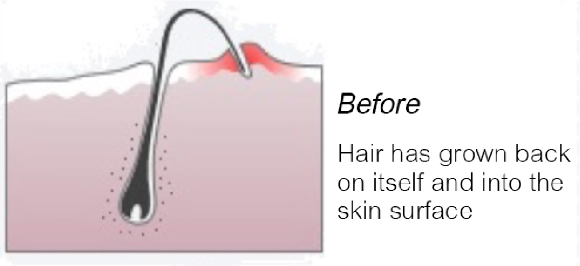 SUGARINGHOUSE sugaringhouse&spas